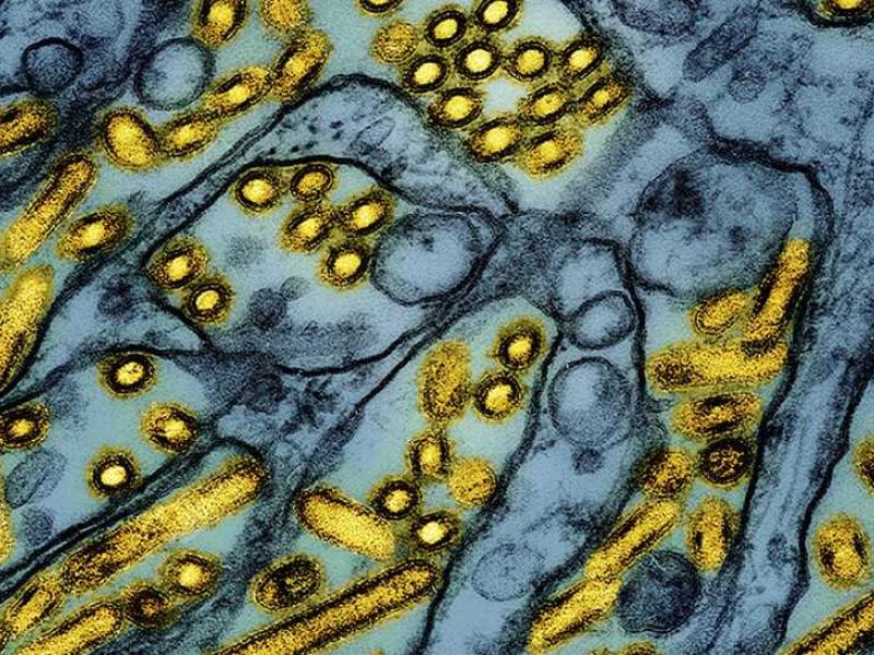 colorized electron microscope image shows avian influenza A H5N1 virus particles (yellow), grown in Madin-Darby Canine Kidney (MDCK) epithelial cells (blue)