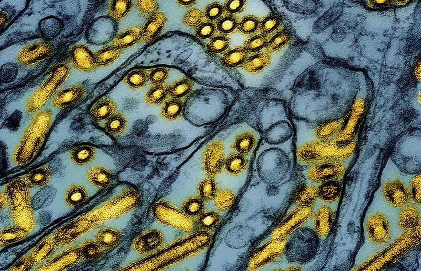 colorized electron microscope image shows avian influenza A H5N1 virus particles (yellow), grown in Madin-Darby Canine Kidney (MDCK) epithelial cells (blue)