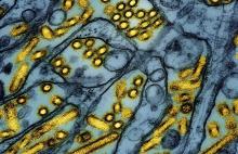 colorized electron microscope image shows avian influenza A H5N1 virus particles (yellow), grown in Madin-Darby Canine Kidney (MDCK) epithelial cells (blue)